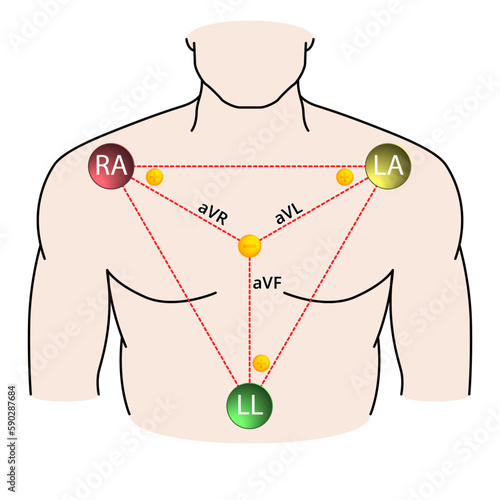 Augmented Limb Leads ECG - Einthoven Triangle - Electrocardiogram - Medical Vector Illustration