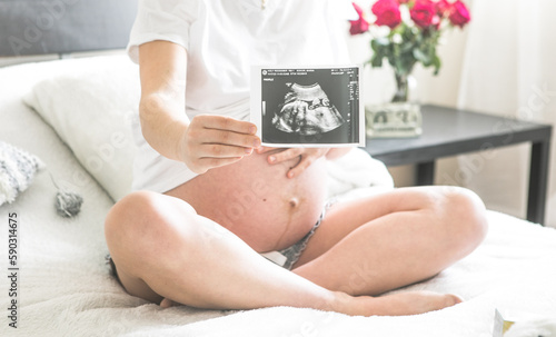 Pregnant woman sitting on a bed holding an X-ray image of her baby.The concept of pregnancy, motherhood and prenatal care. Mom with a new life.