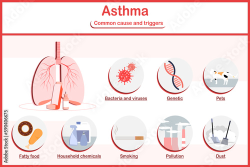 Vector illustrations infographic.human lungs with inhaler and common cause and triggers of asthma,pollution,pets,fatty food,dust,smoking,genetic.flat style.