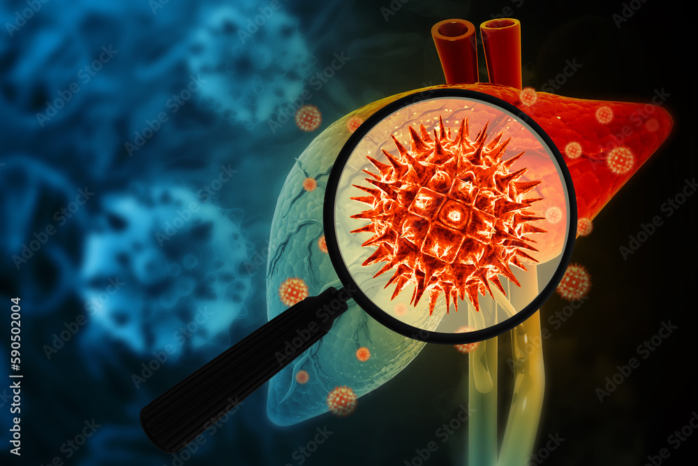 Hepatitis c virus infection. Liver disease. 3d illustration - obrazy, fototapety, plakaty 
