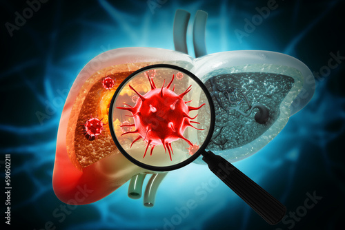Magnifying glass showing the hepatitis c virus infection. Liver disease. 3d illustration photo