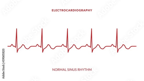 animated normal sinus rhythm. animated ekg display