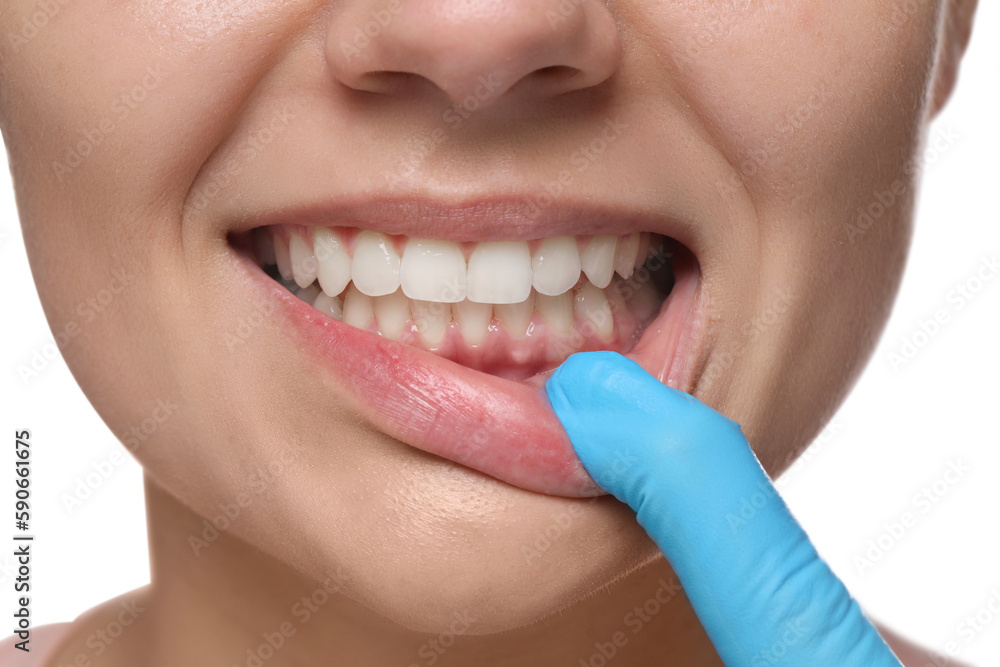 Fototapeta premium Woman showing healthy gums on white background, closeup