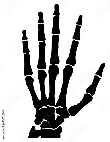 Illustration of an xray of the hand bones
