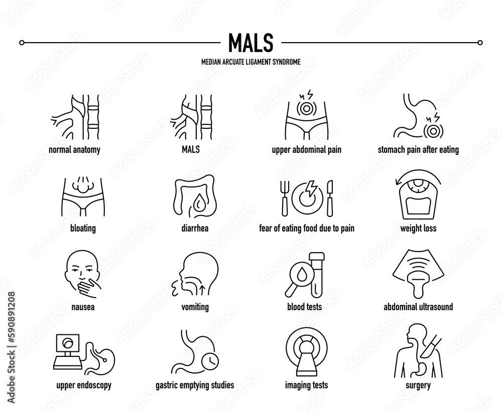 MALS, Median Arcuate Ligament Syndrome symptoms, diagnostic and treatment vector icon set. Line editable medical icons.