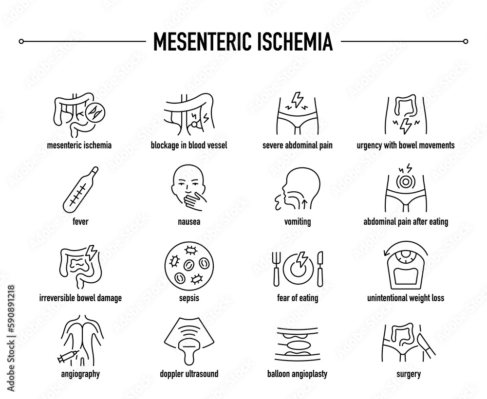 Mesenteric Ischemia symptoms, diagnostic and treatment vector icon set. Line editable medical icons.