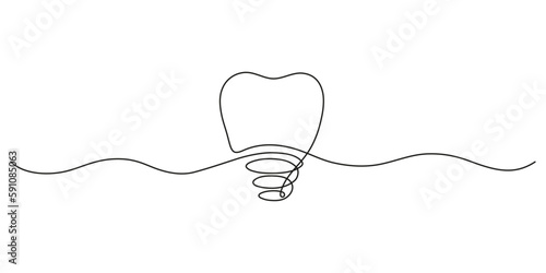 Implant tooth, continuous art line drawing. Dentistry health of teeth. Single hand drawn outline style. Vector