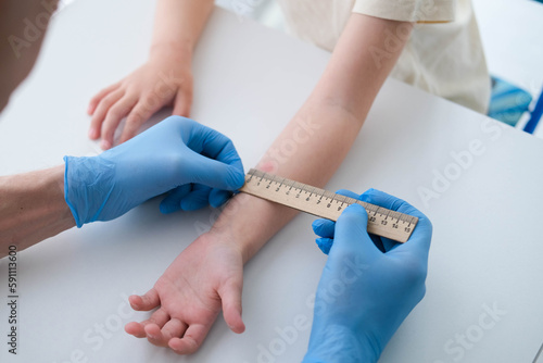 A male doctor makes an important Mantoux test on a child. The doctor measures the Mantoux test with a ruler for a little boy