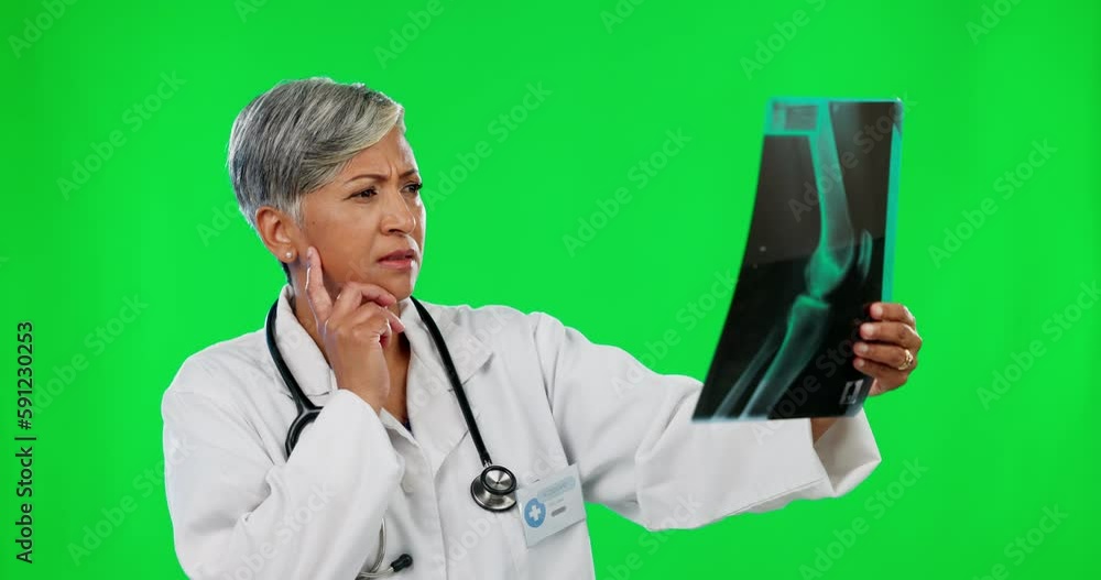 X ray, green screen and mature doctor analyzing results planning treatment and isolated in a studio background. Medical, research and woman healthcare professional reading MRI scan for surgery X ray, green screen and mature doctor analyzing results planning treatment and isolated in a studio background. Medical, research and woman healthcare professional reading MRI scan for surgery