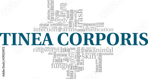 Tinea Corporis - Ringworm word cloud conceptual design isolated on white background.