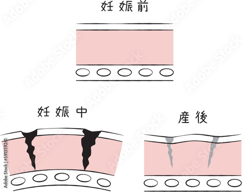 手描き1colo妊娠前、妊娠中から産後までのお腹の肌トラブルあr マタニティ 検診・診察　対面　女医