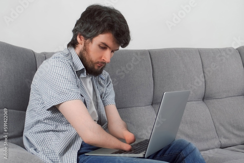 Handicapped Disabled man with amputated two stump hands working typing on laptop at home office sitting on sofa. Problem adaptation to life people with disabilities. Independent Invalid person.