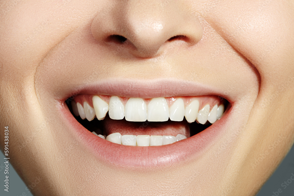 Obraz premium Dental Beauty. Beautiful Macro with perfect White Teeth. Whitening Tooth, Wellness Treatment