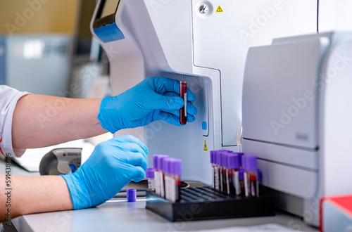 Hospital healthcare clinic tube analyzing. Modern laboratory for blood testing.