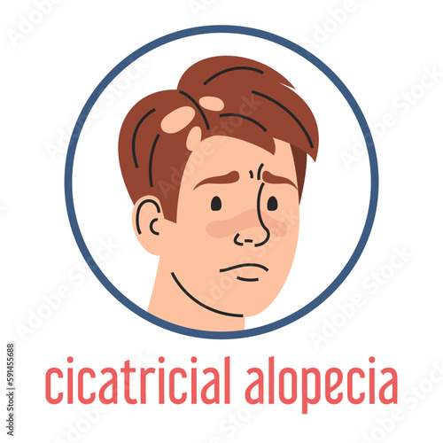 Cicatricial alopecia vector isolated. Sad man portrait, hair loss, medical condition. Autoimmune disease. Receding hair, unhealthy condition.