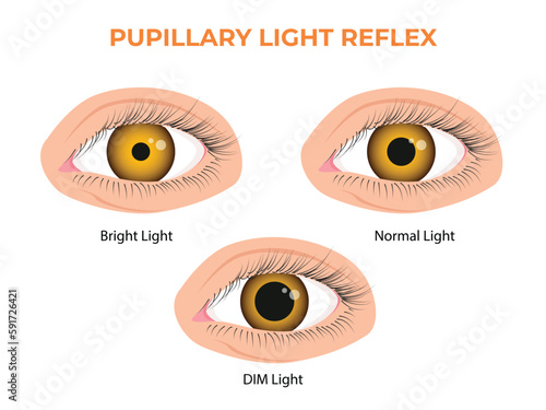 Pupillary light reflex PLR or photopupillary reflex photo