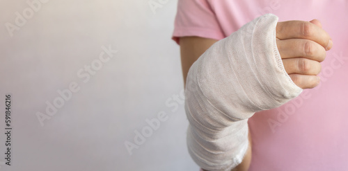 Close-up of a woman's broken arm in a cast. The girl holds a bent arm against the background of a pink t-shirt..Appropriate treatment in Western medicine. Banner, copy space.