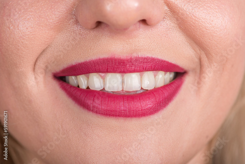 Curious Woman Face With Pretty Smile and White Teeth. Studio Photo Shoot. Use Bright Red Lipstick. Open Mouth