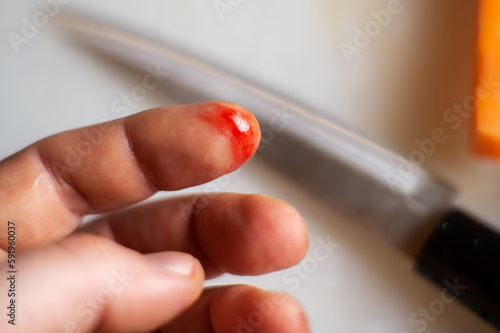 Fotografie finger cut in the kitchen