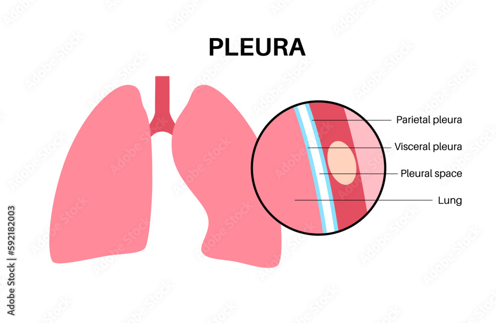 Pleura anatomical poster Pleura anatomical poster