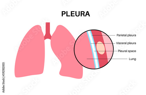 Pleura anatomical poster