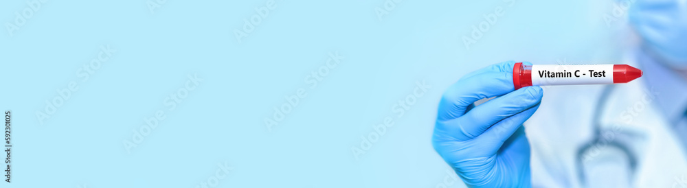 Doctor holding a test blood sample tube with Vitamin ? test. Banner. Copy space for text. Doctor holding a test blood sample tube with Vitamin ? test. Banner. Copy space for text.