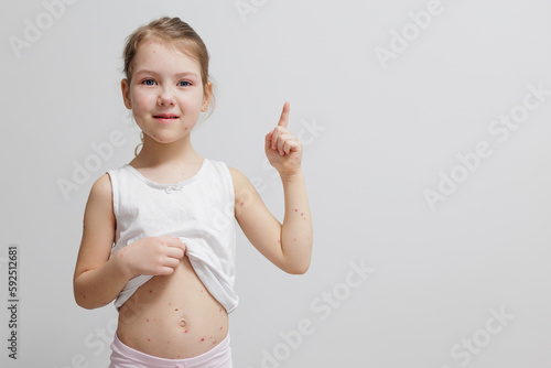 Child with pimples of chickenpox pointing on copy space photo