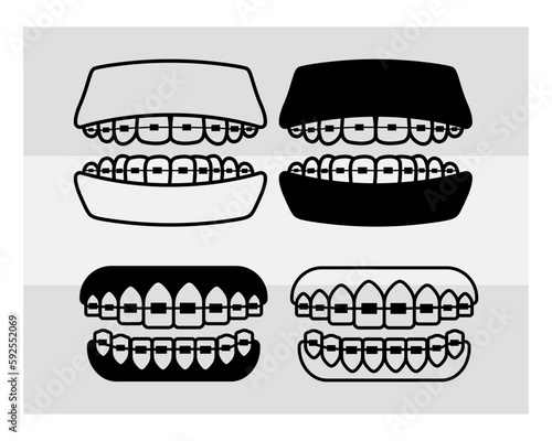 Fake Braces, Fake Braces Kit, Fake Braces Clip On, Braces Svg, Dental Braces For Kids, Braces Clipart, Teeth Svg, Braces Silhouette, Dentist, Dental Hygienist, Braces Outline, Eps, Cut file