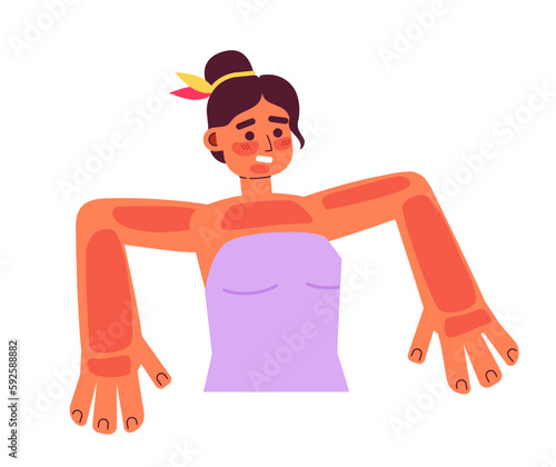Young woman with severe sunburns semi flat colorful vector character. Indoor tanning. Editable half body person on white. Simple cartoon spot illustration for web graphic design and animation