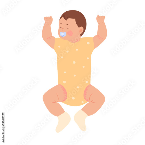 Pediatric Eczema or Atopic Dermatitis in infants and children. Baby with diaper rash, skin rash, allergy. Redness of skin in children.Dermatological problems. Vector illustration