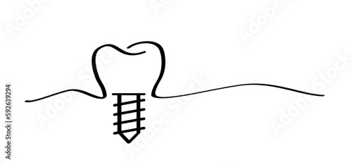 Dental implant, medically accurate or dental bridge. Cartoon healthy, tooth with gums. Molar line pattern. Drawing tooth with screw. Damage teeth or tooth with caries. Surgery jaw, medicine screw.