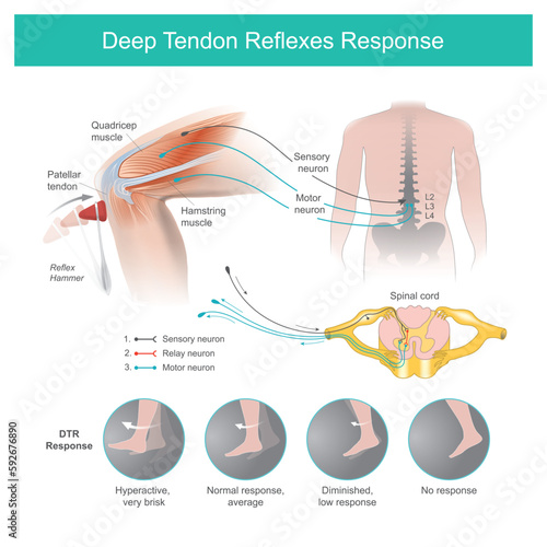 Deep Tendon Reflexes Response. The doctor testing nervous systems by a Reflex Hammer using knocking on the tendon in the knee area causing the shin to move automatically..