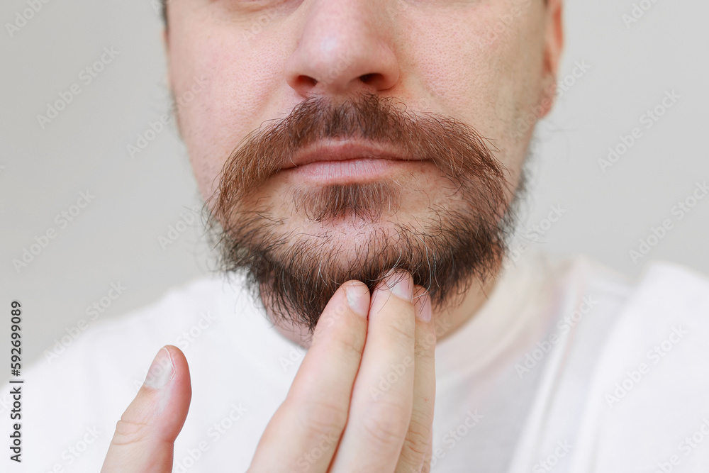 Cropped photo of bearded man shows first gray hairs on overgrown shaggy beard and moustahe. Loss of melanin at young age, causes-genetic predisposition, hormonal, disorders of the endocrine system Cropped photo of bearded man shows first gray hairs on overgrown shaggy beard and moustahe. Loss of melanin at young age, causes-genetic predisposition, hormonal, disorders of the endocrine system