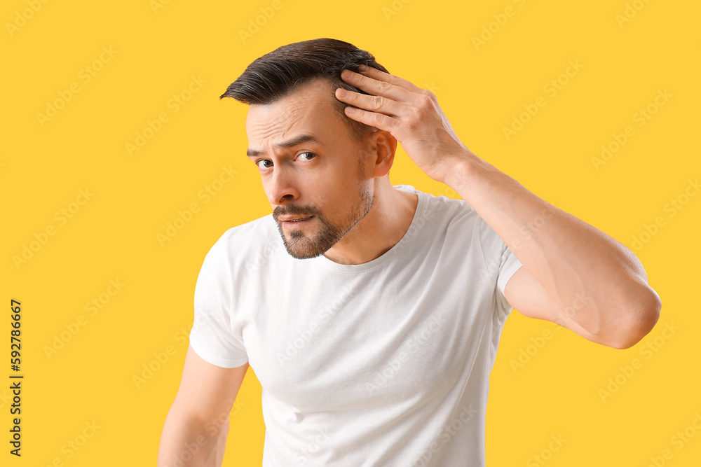 Worried young man with hair loss problem on yellow background Worried young man with hair loss problem on yellow background