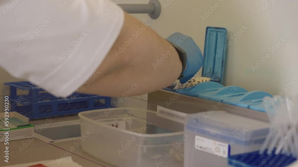 Doctor Puts Microscope Slides For Medical Blood Test Into Container ...