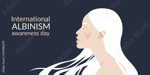 International Albinism Awareness Day. The face of an albino girl and developing white hair with a heart on her cheek. Natural appearance. Vector illustration