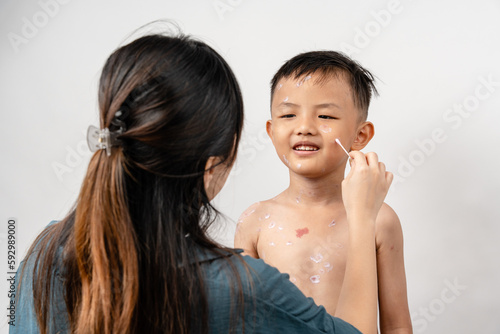 Foto A mother is applying itching ointment to him 7 year old Asian boy suffering from chickenpox