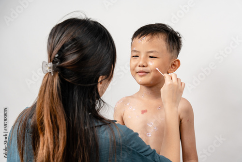 Foto A mother is applying itching ointment to him 7 year old Asian boy suffering from chickenpox