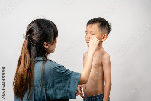 Φωτογραφία A mother is applying itching ointment to him 7 year old Asian boy suffering from chickenpox