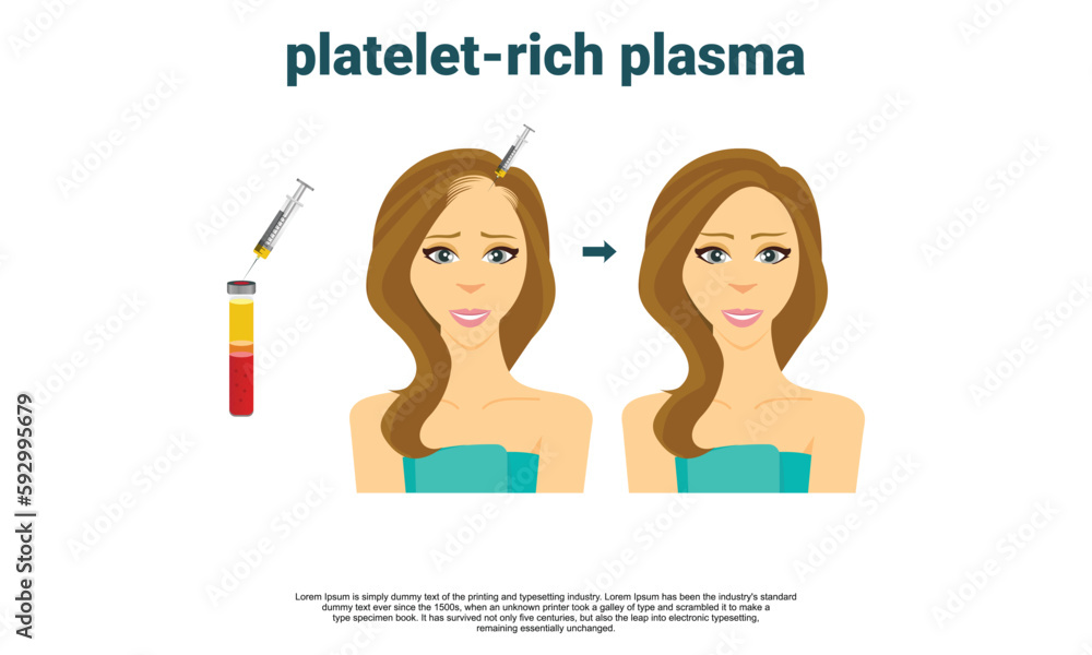 Platelet rich plasma injection procedure. PRP therapy process. hair