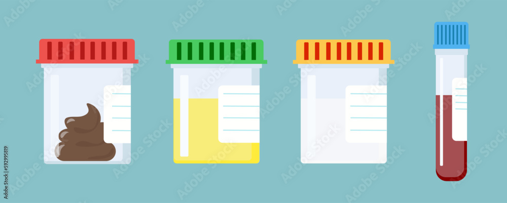 Set of vector test tubes with caps. Stool, blood, urine, sperm. Pharmacy treatment vector illustration Set of vector test tubes with caps. Stool, blood, urine, sperm. Pharmacy treatment vector illustration