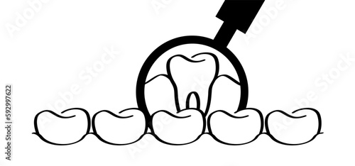 For dental day, dentists day. Cartoon healthy, magnifying glass showing tooth in-gums. Vector drawing icon. Damage teeth or tooth with caries and with roots visible. Cracked, damaged logo