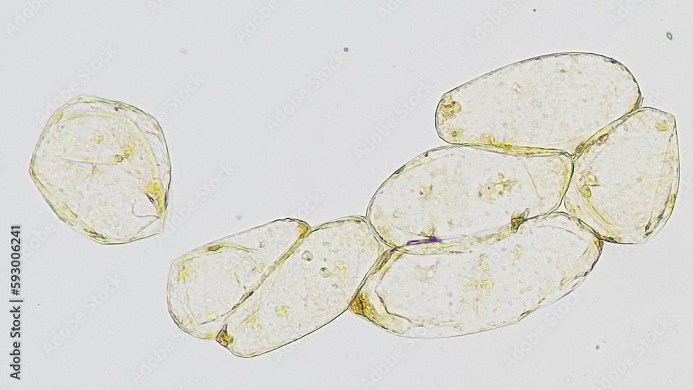 Microscopic view of a banana pulp cells. Stained by lugol iodine