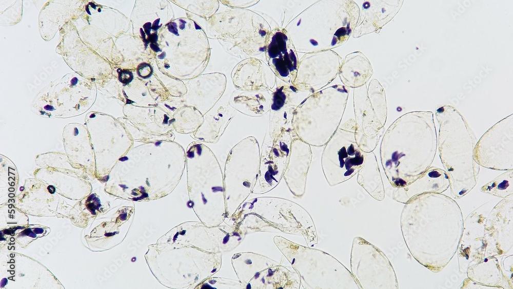 Microscopic view of a banana starch granule in banana pulp cells