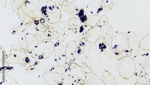 Bilde på lerret Microscopic view of a banana starch granule in banana pulp cells