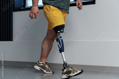 Unrecognisable male in yellow coloured shorts wearing prosthetic leg walking in luminous spacious corridor