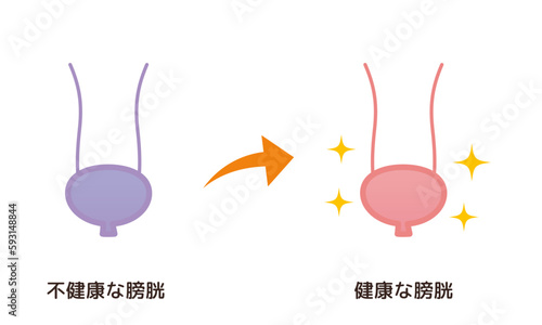 不健康な膀胱→健康な膀胱のイメージ
