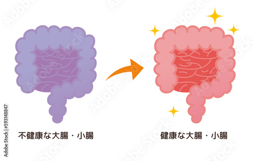不健康な大腸・小腸→健康な大腸・小腸のイメージ