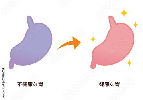 不健康な胃→健康な胃のイメージ