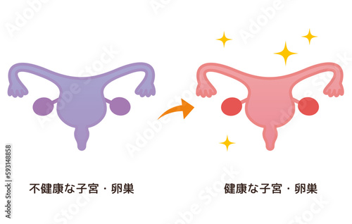 不健康な子宮・卵巣→健康な子宮・卵巣のイメージ
